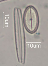 Diatom